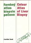 Farebn atlas biopsie peene